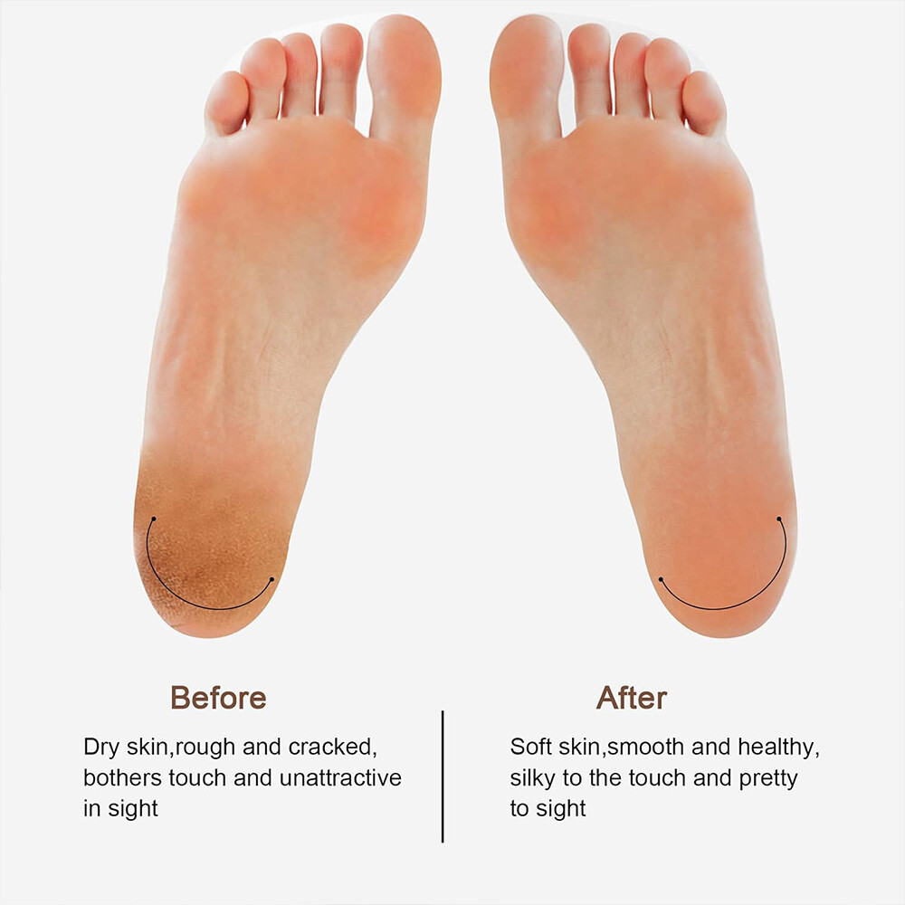 Electric Foot File Rechargeable Callus Hard Skin Remover Feet Pedicure 2 Speeds — image 12