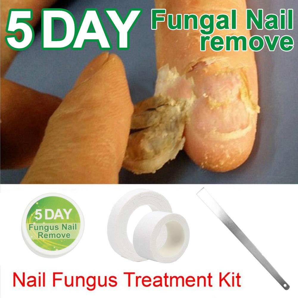 Gray nail remover cream