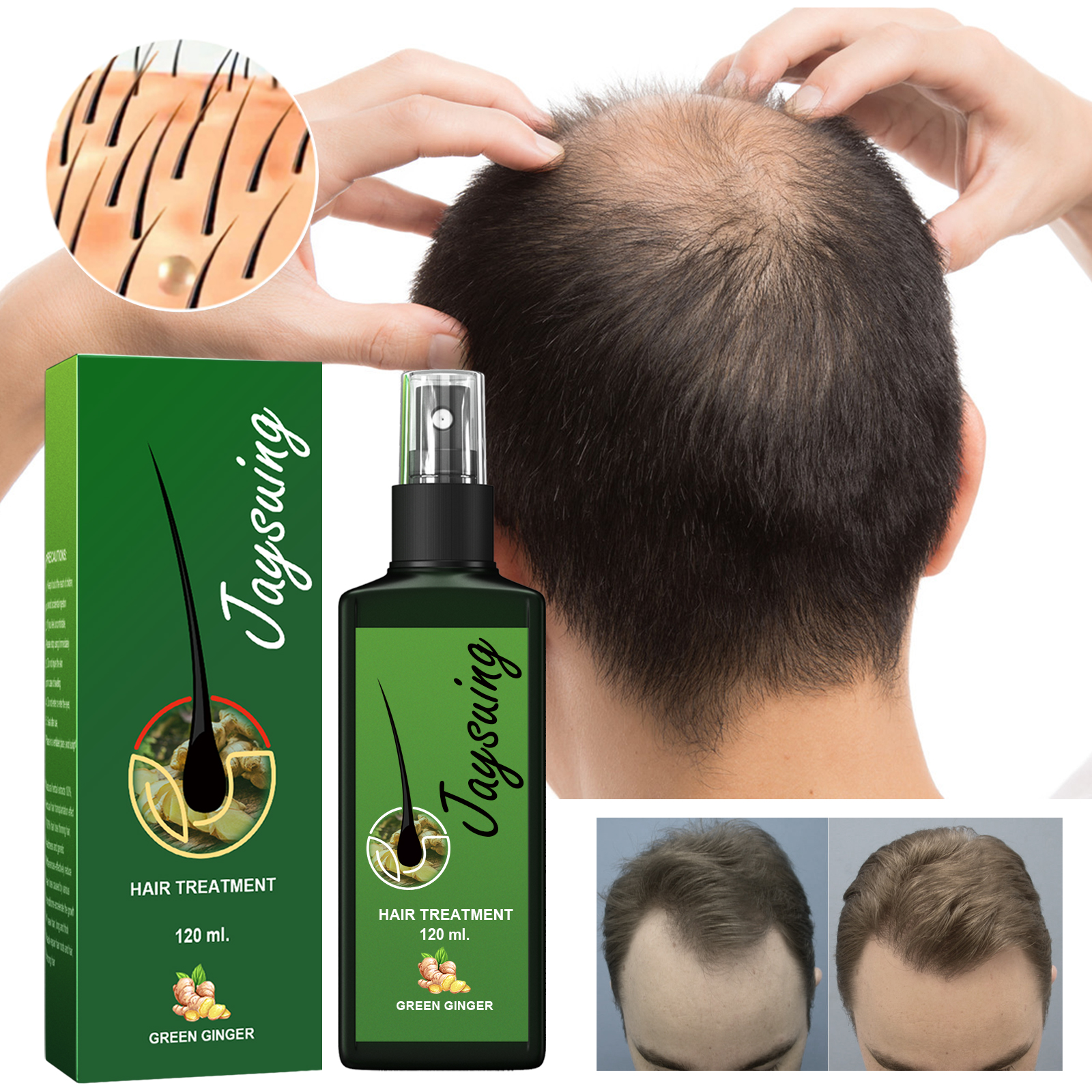 Jaysuing Hair Treatment, Strengthens Hair, Nourishes Root Growth And Thickens Scalp Massage Nutrient Solution - Image 5