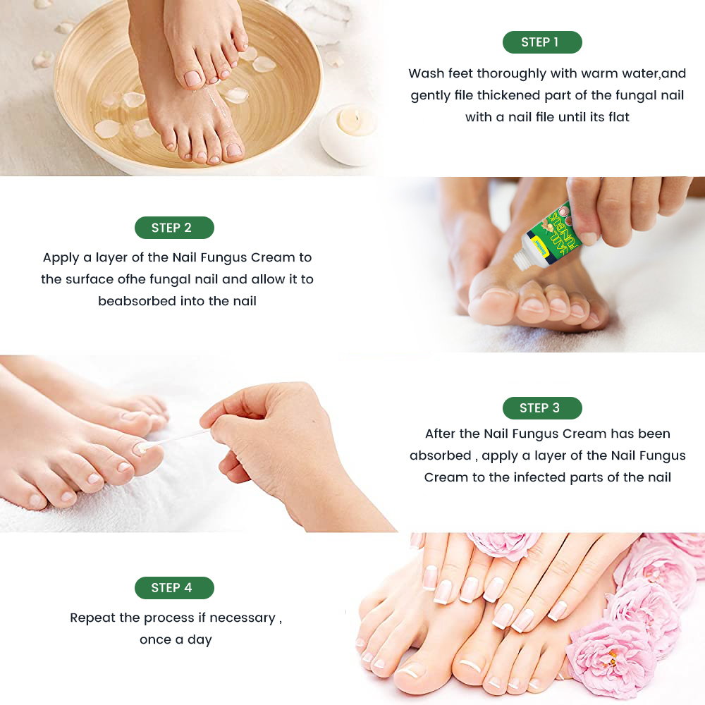 Nail Essential Oil Repair Gel,Fungal Nail Treatment Cream,Foot Repair Toe Nail Fungus Removal