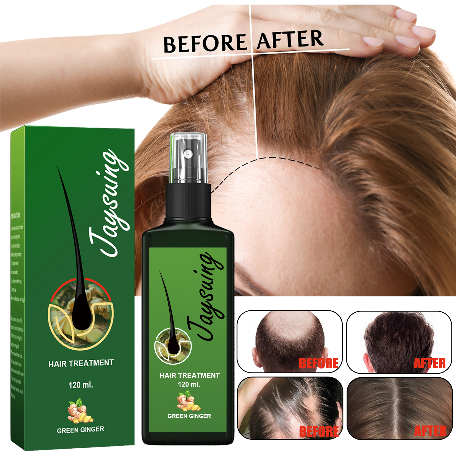 Jaysuing Hair Treatment, Strengthens Hair, Nourishes Root Growth And Thickens Scalp Massage Nutrient Solution