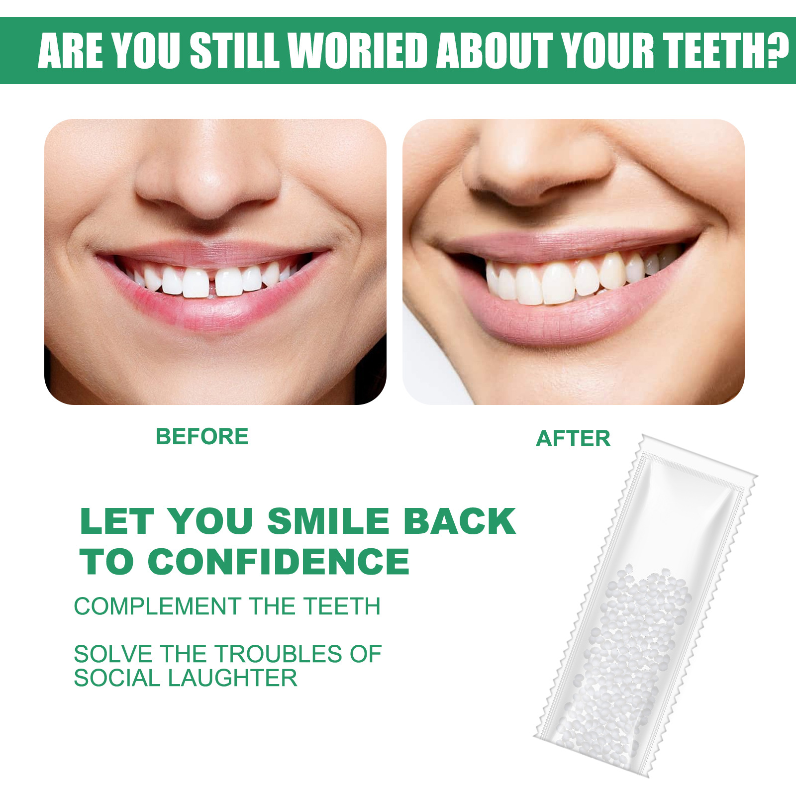 EELHOE Solid Dental Glue, Film And Television Makeup Denture Modification Temporary Fillings Dental Glue False Fillings Holes And Gaps
