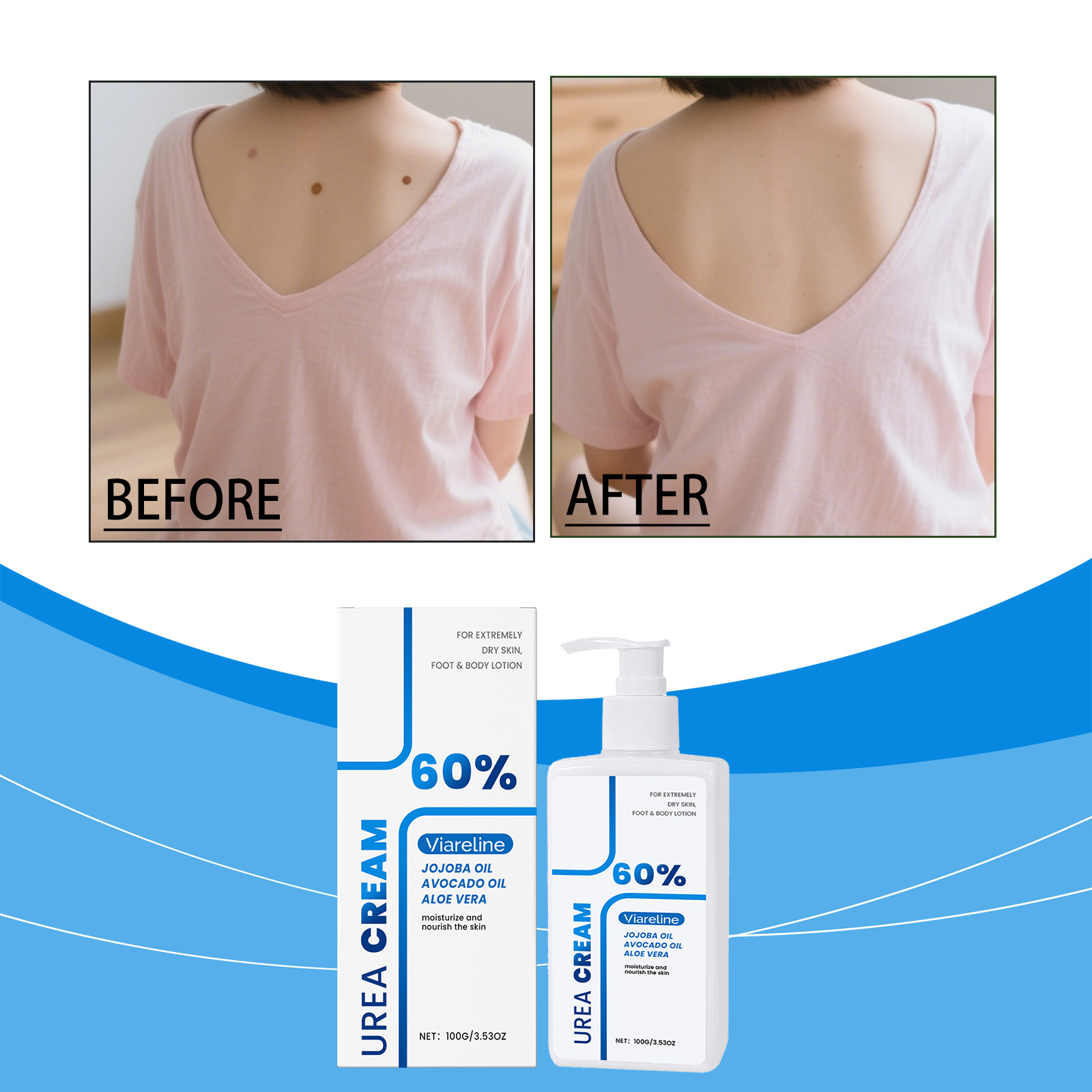 Urea Body Lotion — foto 6