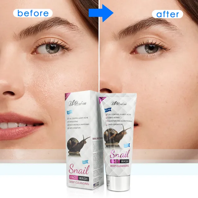DR.ROSEVA Snail Facial Private Label Factory Customize Face Wash Smooth And Moisturized Skin Care Set Cleanser - Shop at LoveMi