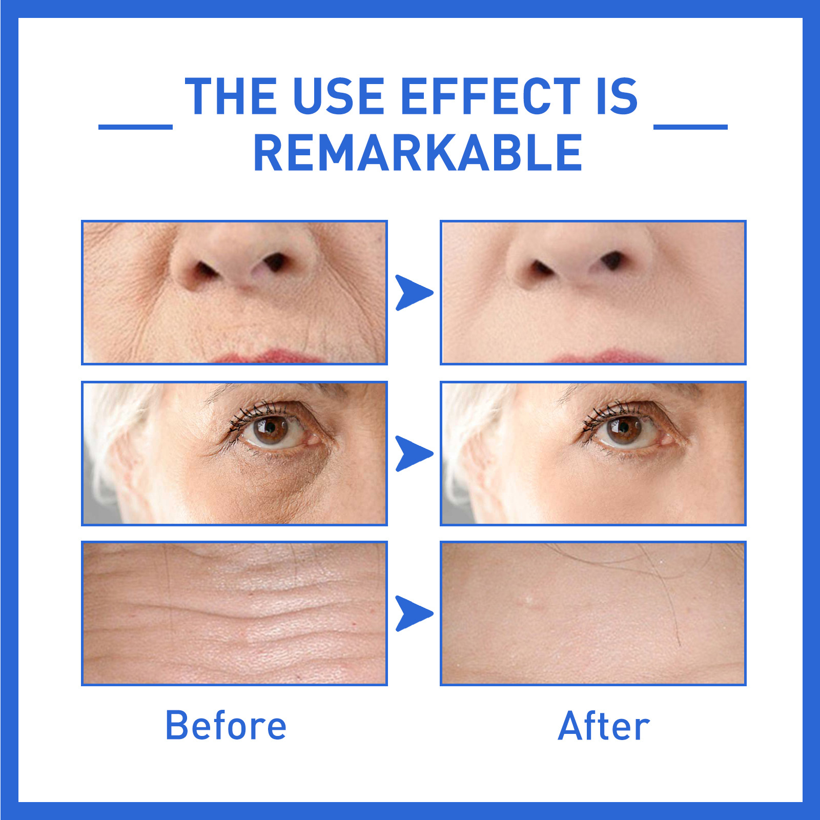 Fade Facial Fine Lines Collagen Anti-Wrinkle - Image 4