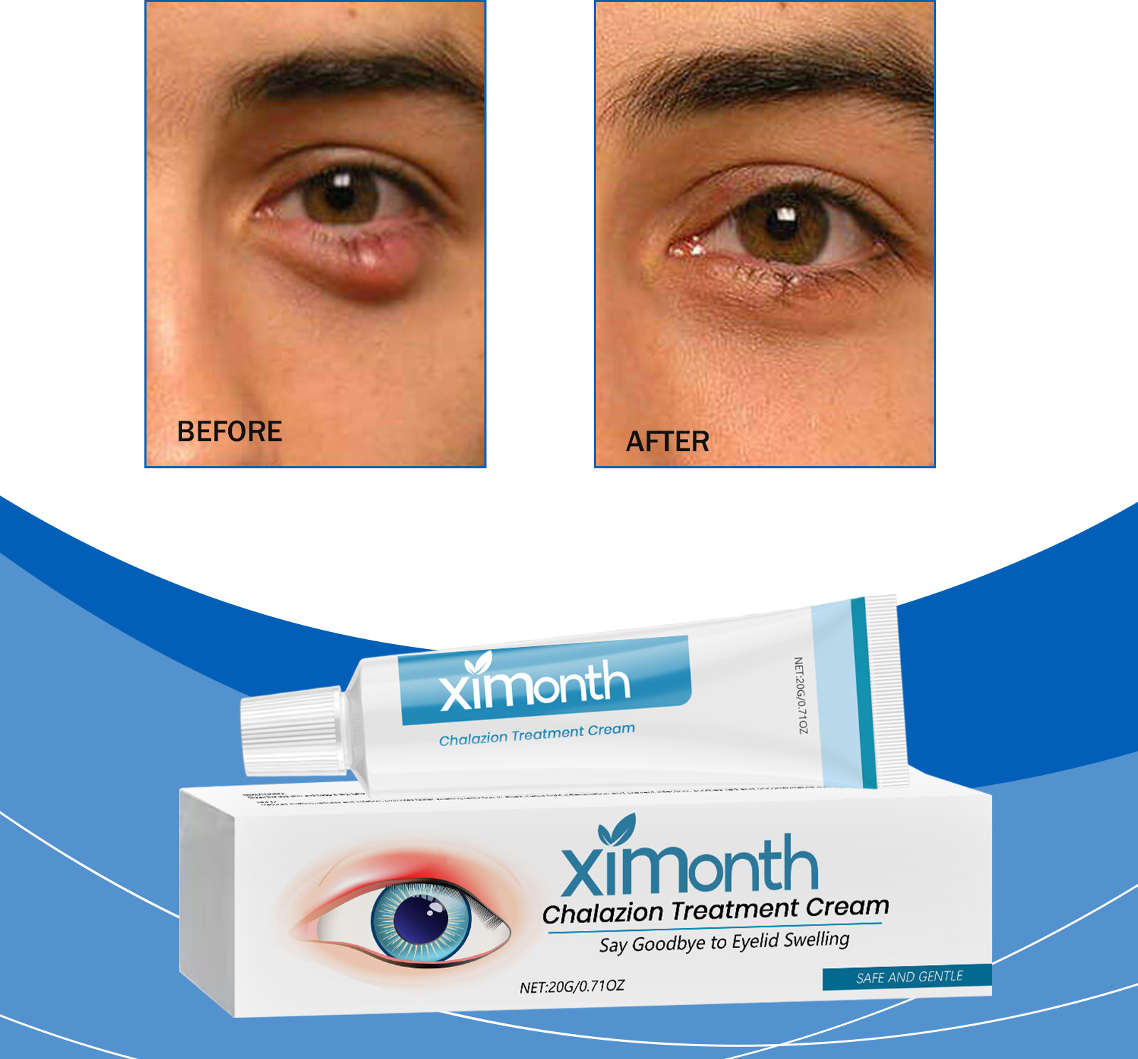 Eye Soothing Cream 20g 1 Box — foto 3