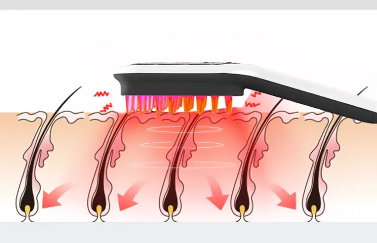 Electric Head Massager Magnetic Therapy Hair Growth