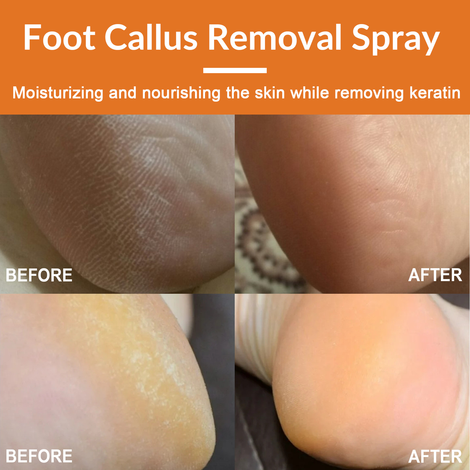 Title 8, Foot Exfoliating Spray Mild Callose Remove Dead...