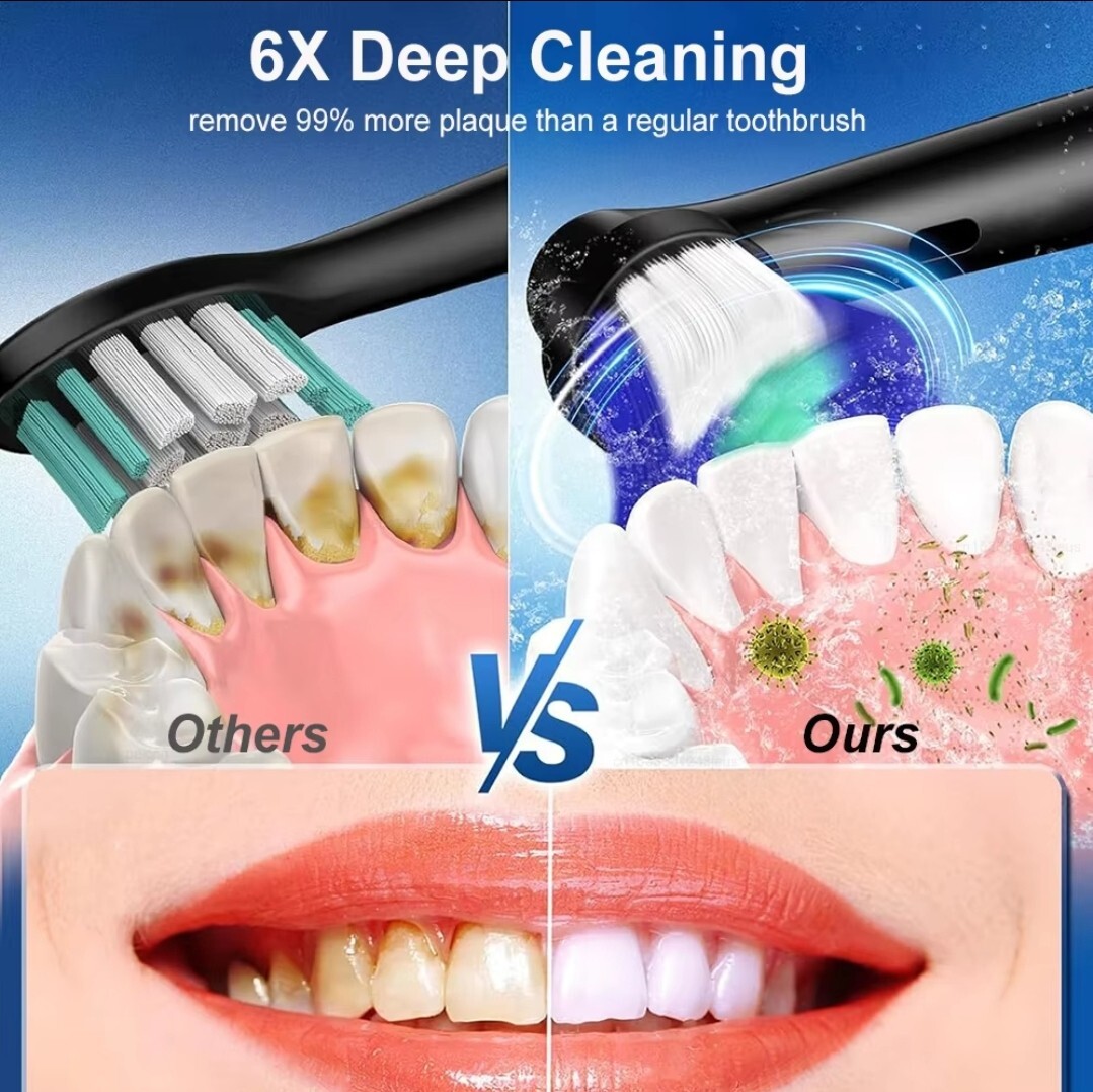 Rotating Electric Toothbrush, Smart Timer 4 Brush Heads 5 Modes USB Rechargeable — image 9
