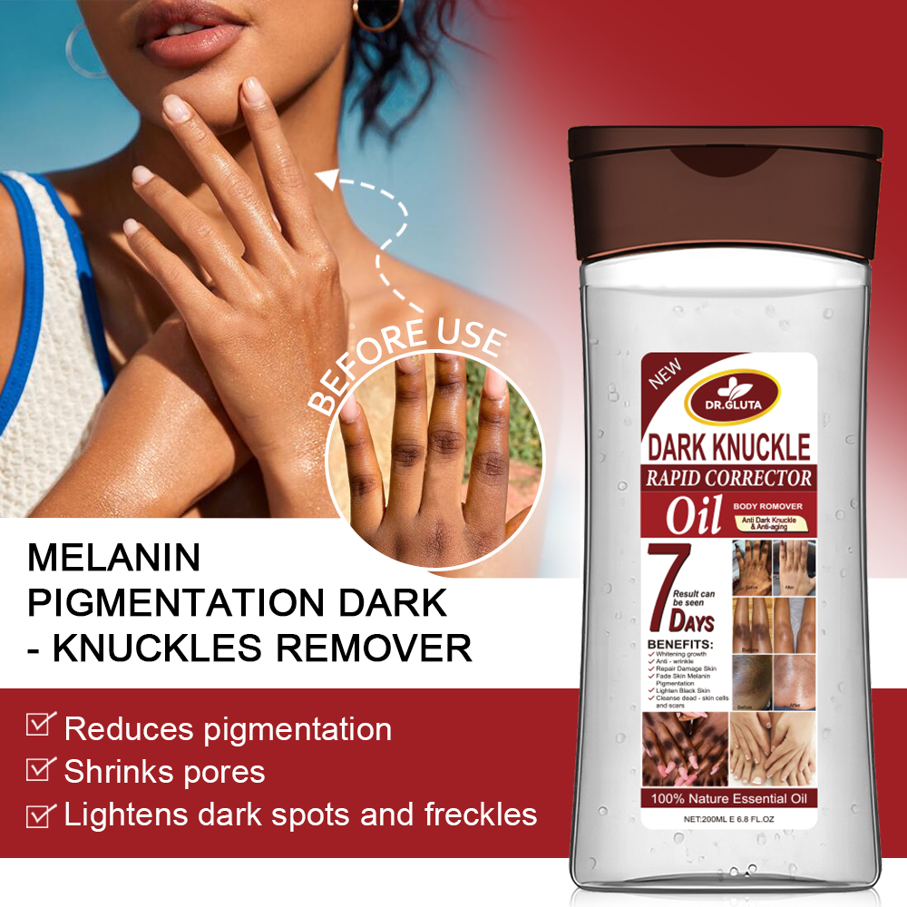 Dark Knuckle Body Oil Anti Dark Knuckle & Anti Aging Whitening Oil Skin Care 200ml