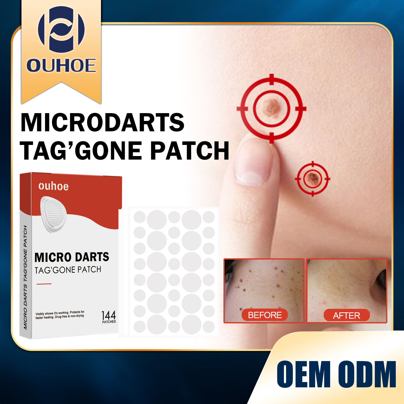 Purifying Face Patches 144PCS