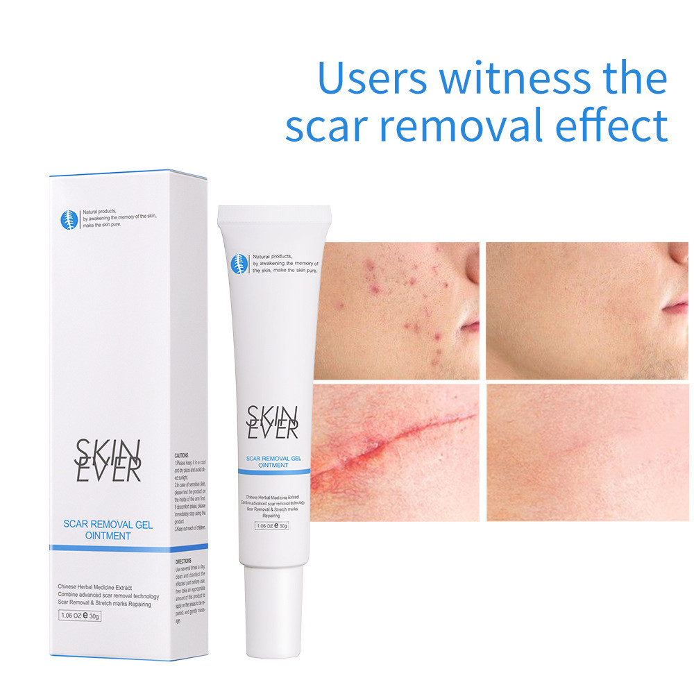 Title 2, HERBAL SCAR REMOVAL GEL OINTME