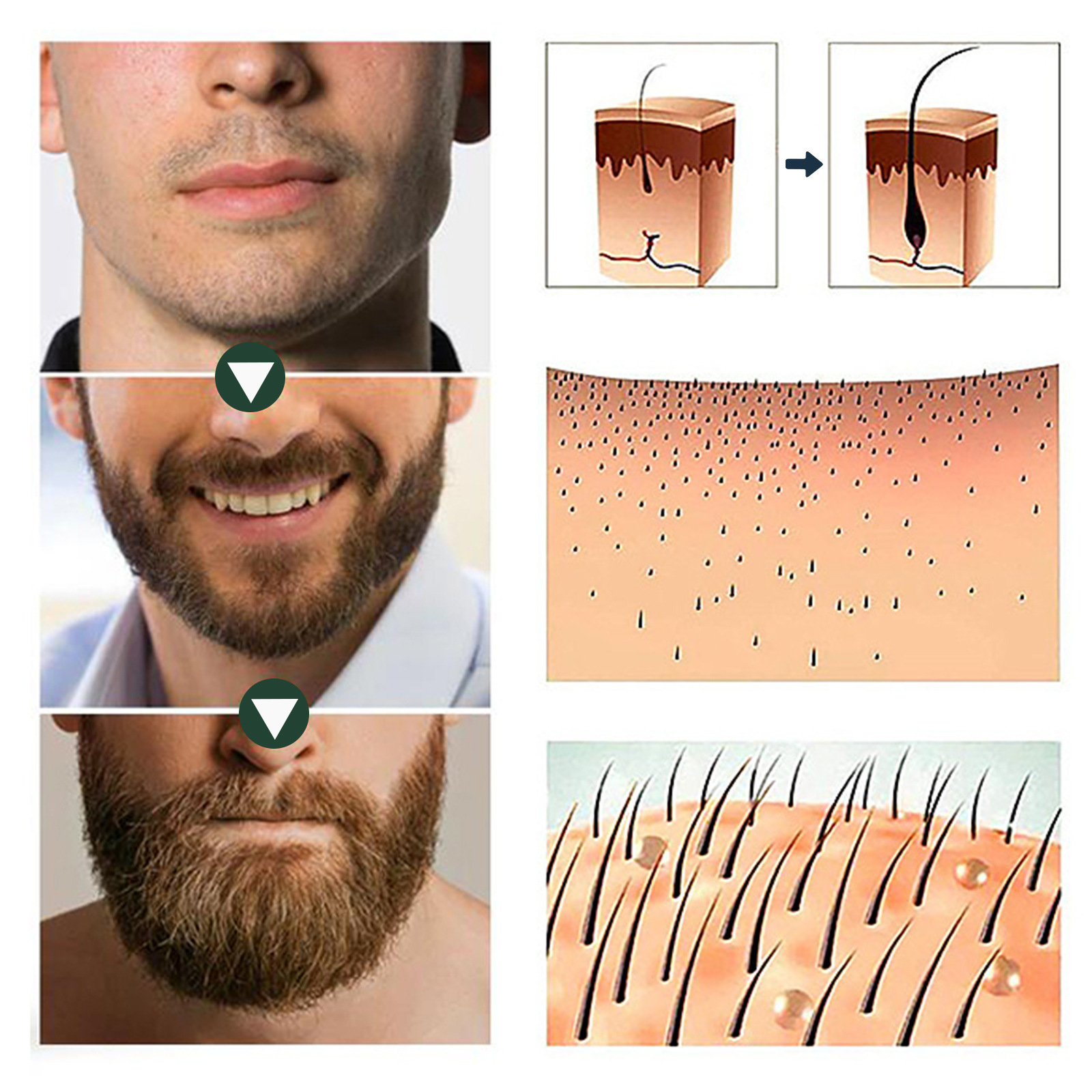 New Hairline Anti-drop - Image 11