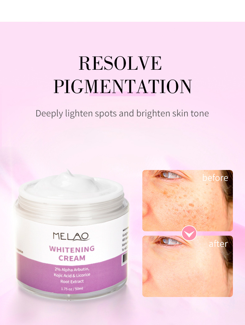 Title 2, Lightening Cream Brightening Skin Color Freshin...