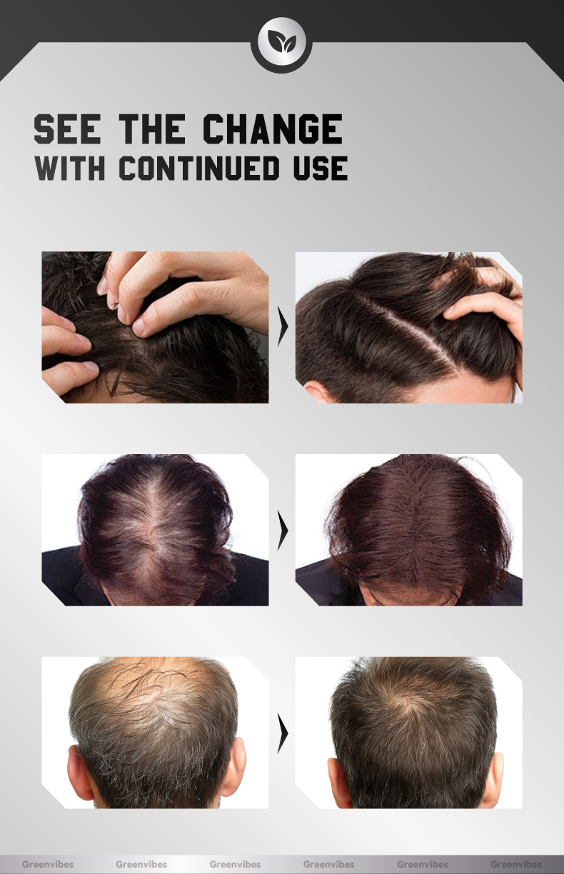 GreenVibes Anti-Breakage Hair Nourishing Essence, Repairs Dry And Frizzy Hair For Silky Smooth Tresses — foto 6