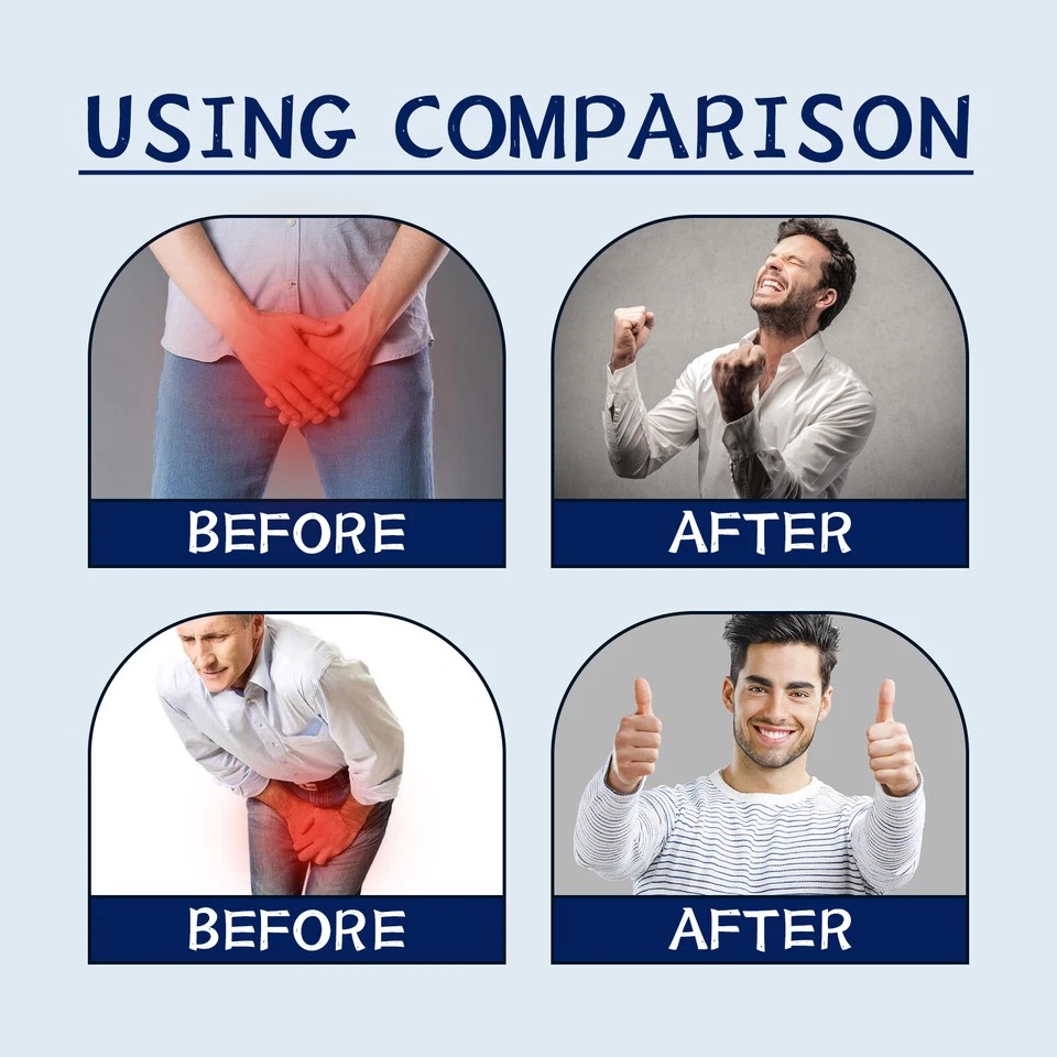Men'S Care Cream Relieve Prostatitis,Male Body Care,Itch Massage Care Cream Private Antipruritus Cream,Prostatitis Pruritus Care