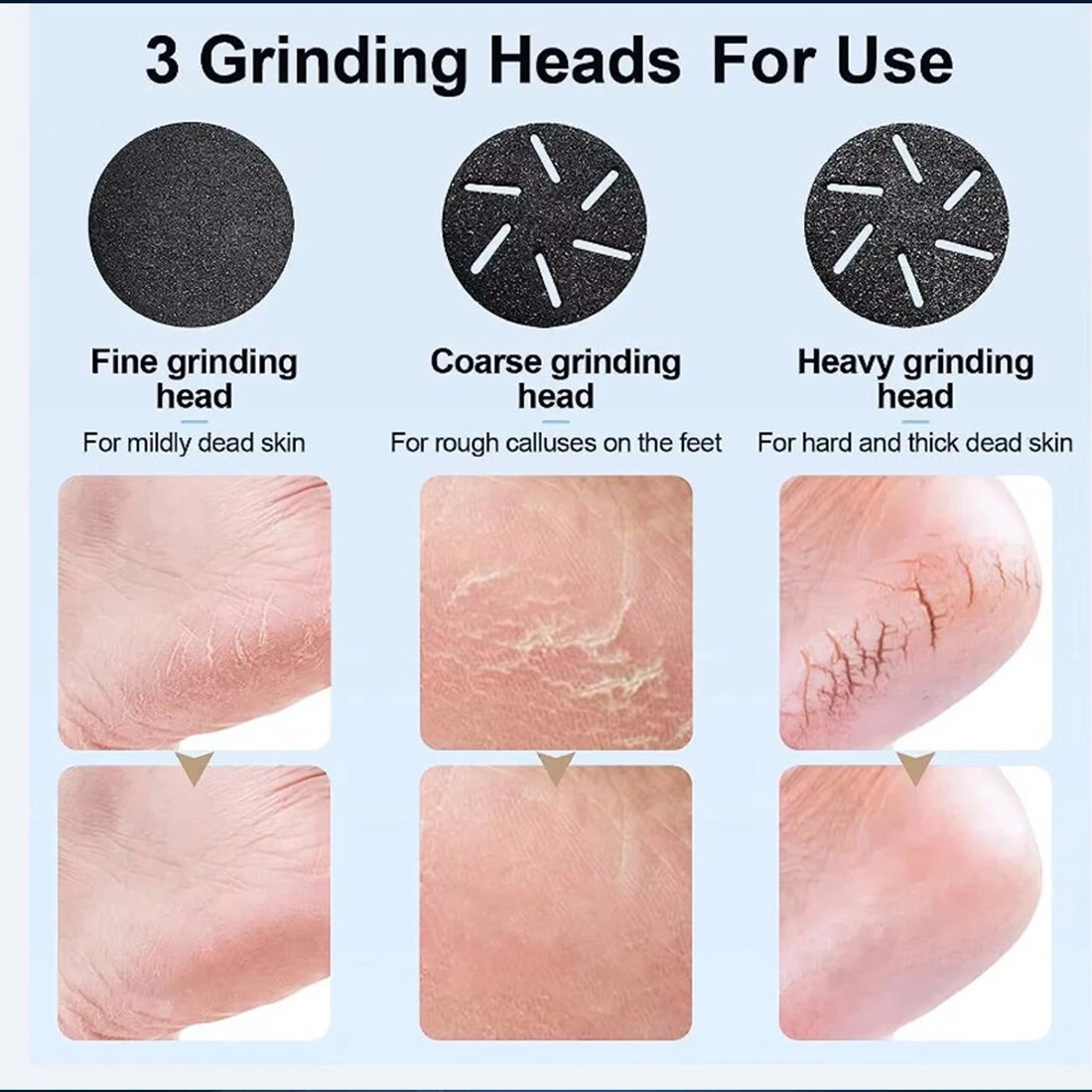 Electric Foot File Waterproof Hard Skin Remover Feet Pedicure Set Rechargeable