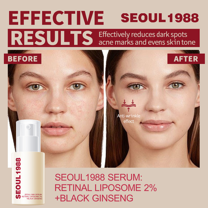 Seoul1988 Serum (3)