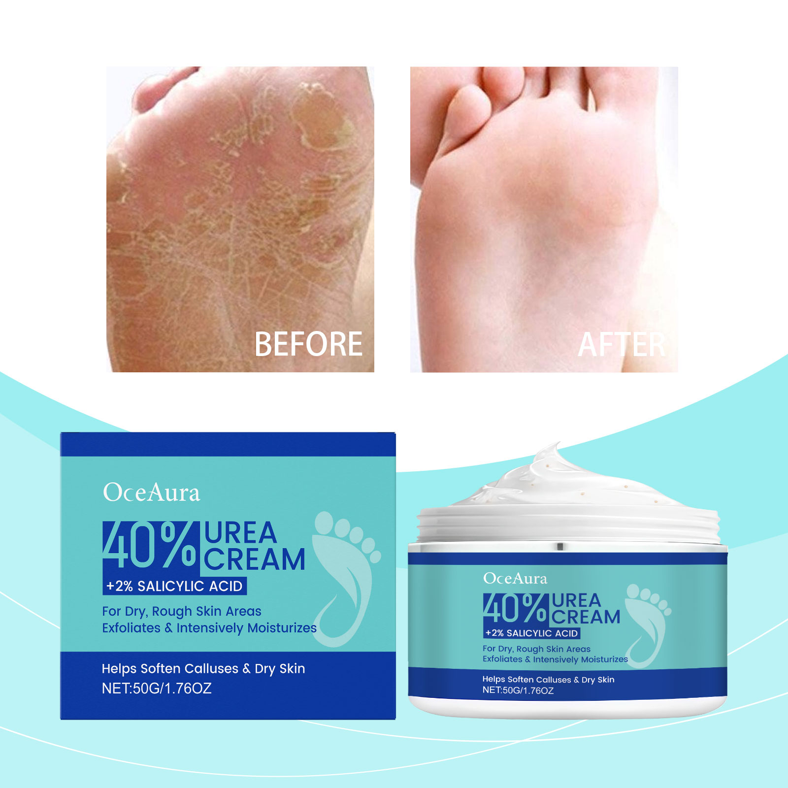 Urea Foot Cream — foto 4