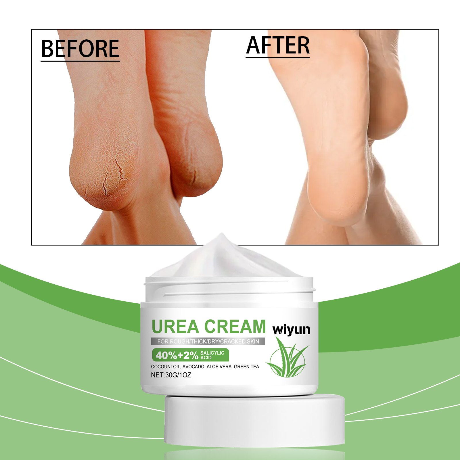 Foot Urea Care Cream — foto 6