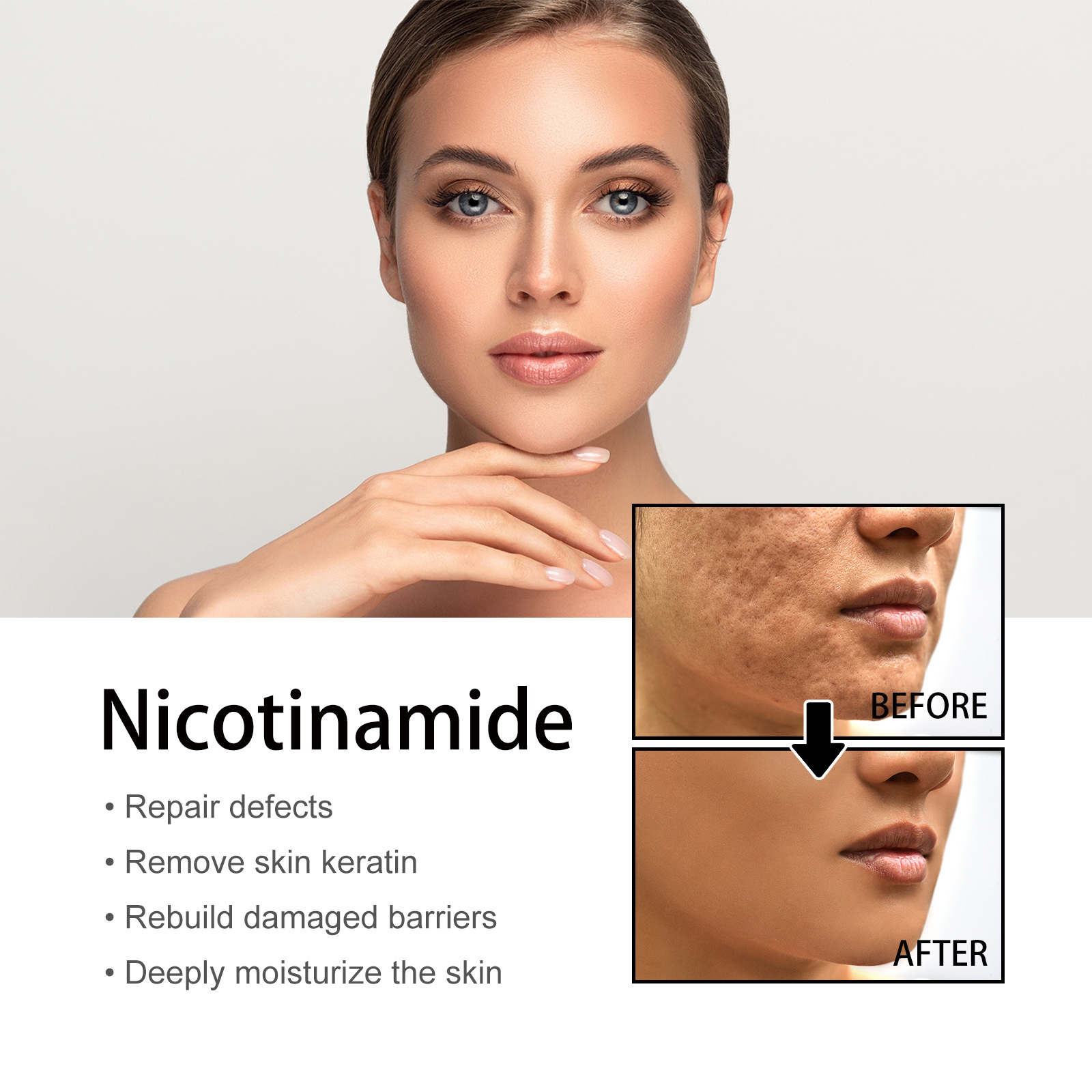 Niacin Facial Pore Shrink Smallpox Diluting Hydrating Moisturizing Whitening Skin Beauty