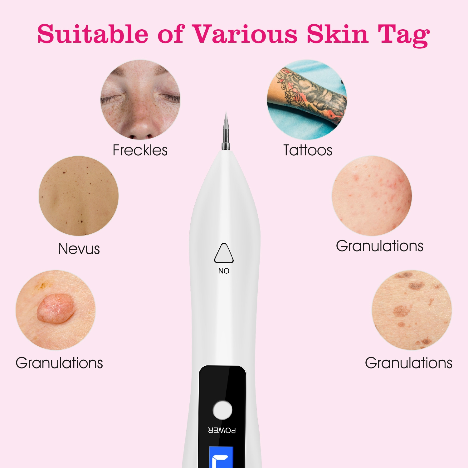 2 PCS Skin Tag Repair Kit Portable Beauty Equipment Multi-Level With Home Usage USB Charging LCD Level Adjustable 12 Replaceable Needles