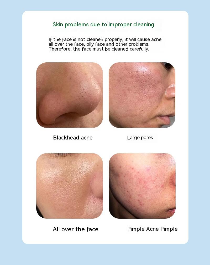 Centella Asiatica Bubble Mask Shrink Pores