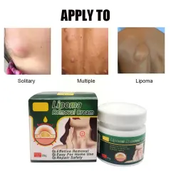 Multiple Anti-tumor Lipoma Pain Cream - 43G - View 1