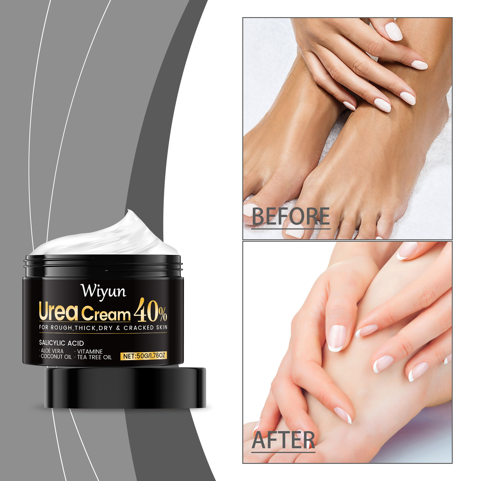Hand And Foot Care Urea Cream — foto 2