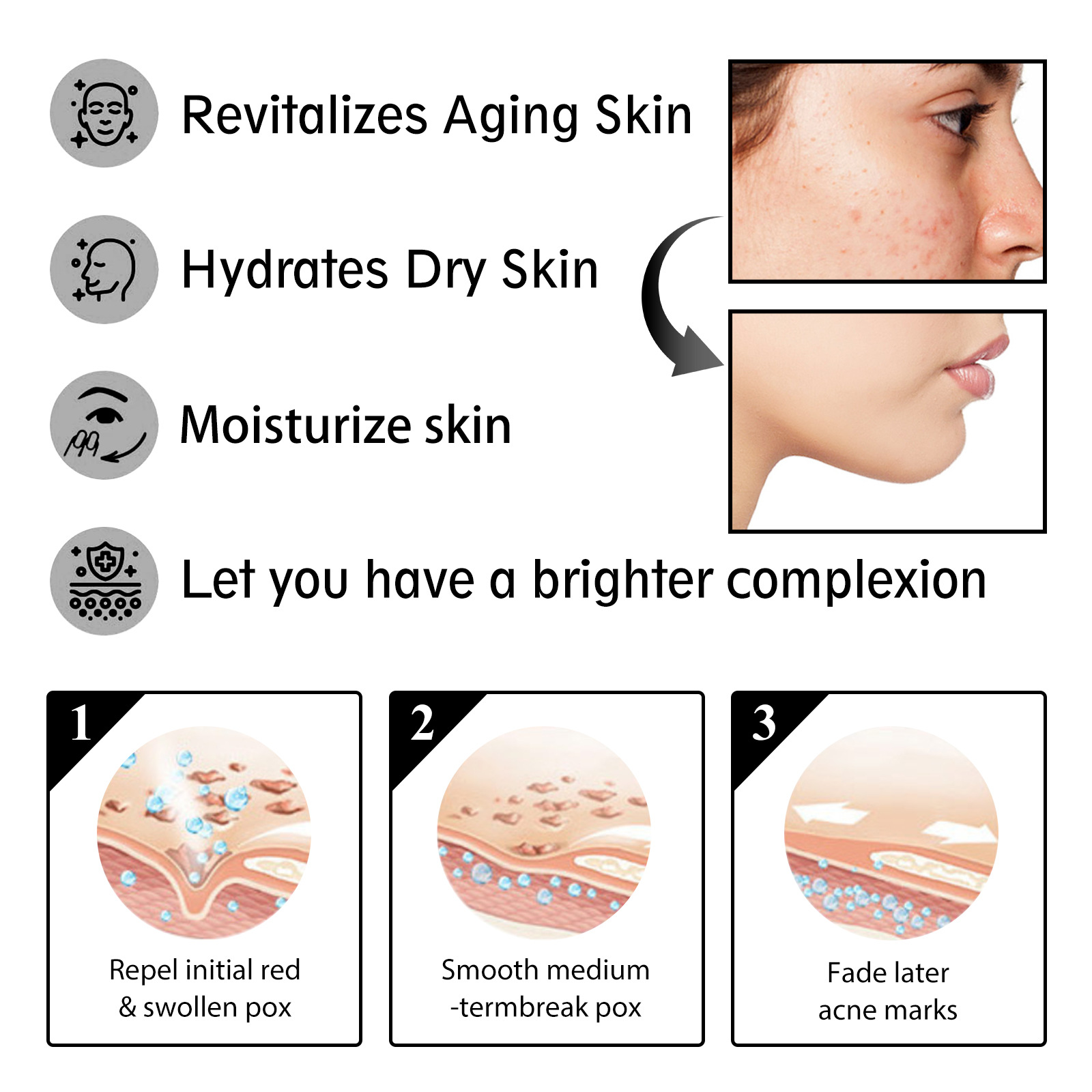 OUHOE Snail Cream Gentle, Nourishing, Hydrating And Firming Facial Skin Moisturizing Care Essence — foto 7