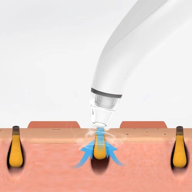 Electric Blackhead Remover Cleaner Face Diamond Pore Vacuum Suction White Heads | Elevated Statement