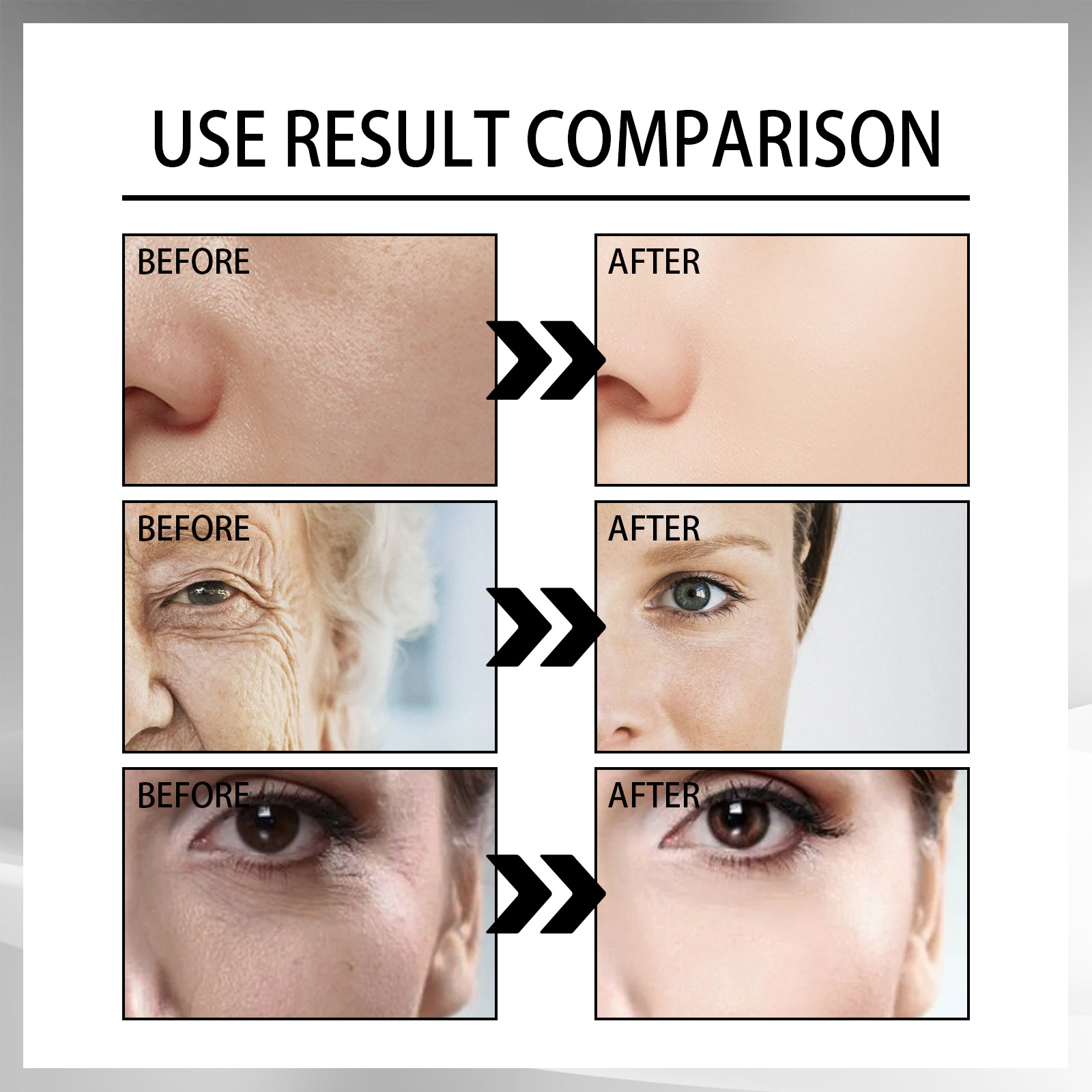 OUHOE Snail Cream Gentle, Nourishing, Hydrating And Firming Facial Skin Moisturizing Care Essence — foto 2
