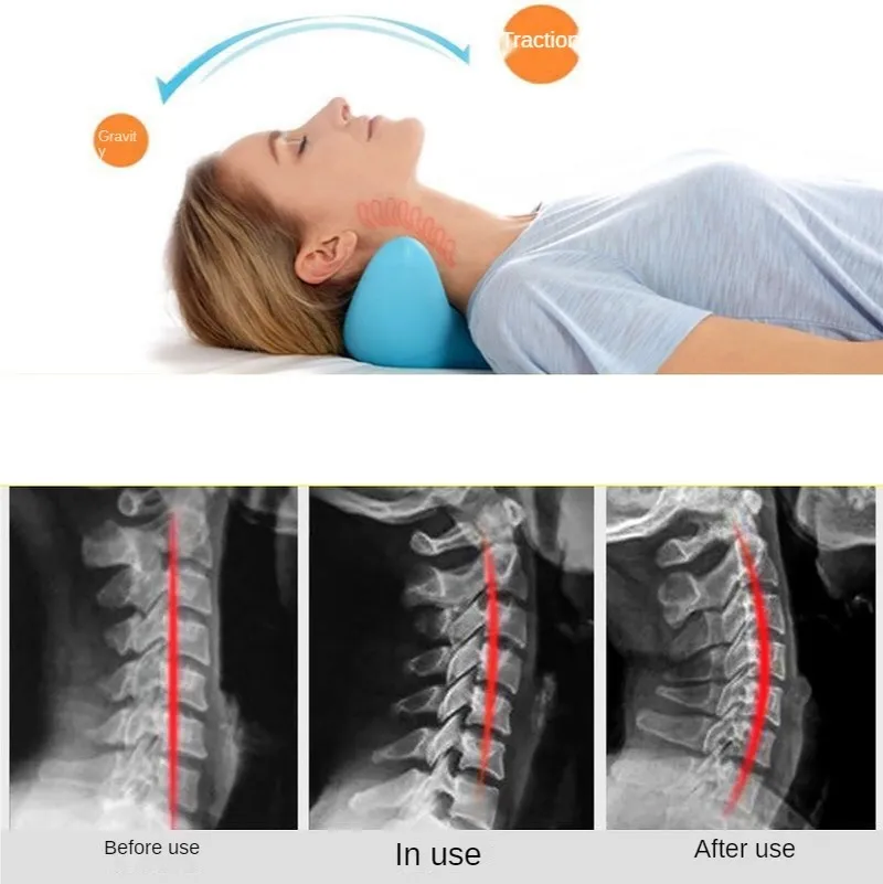 Cervical Spine Massage Pillow Gravity Acupressure Neck Massager Cervical Spine Pillow Neck Shoulder Massage Pillow Home Traction Corrector – image 2