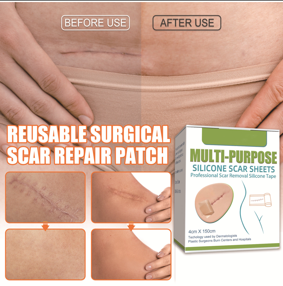 Silica Gel Scar Repairing Stickers