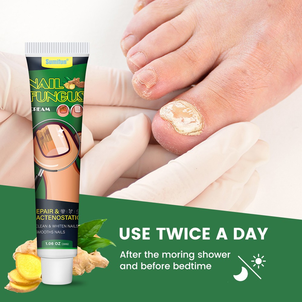 Nail Essential Oil Repair Gel,Fungal Nail Treatment Cream,Foot Repair Toe Nail Fungus Removal
