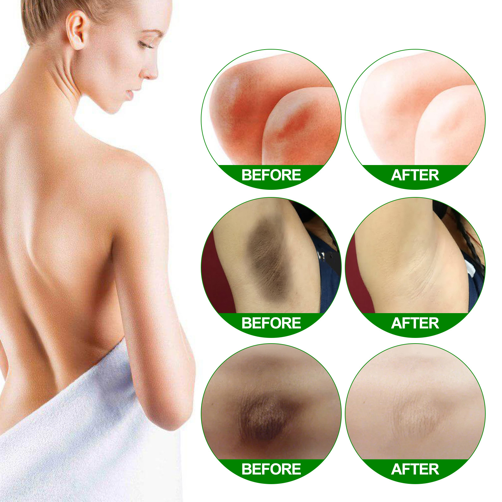 Underarm Brightening Cream 10ml 1 Bottle — foto 8