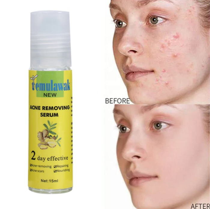 Temulawak - New Acne Removing Serum 4
