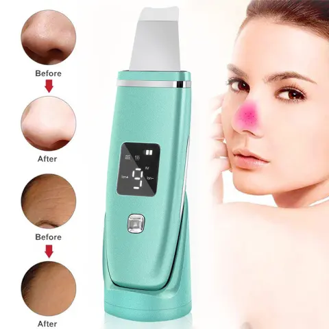 Ultrasonic Vibration Blackhead Remover Deep Cleansing Face Scrubber Pore