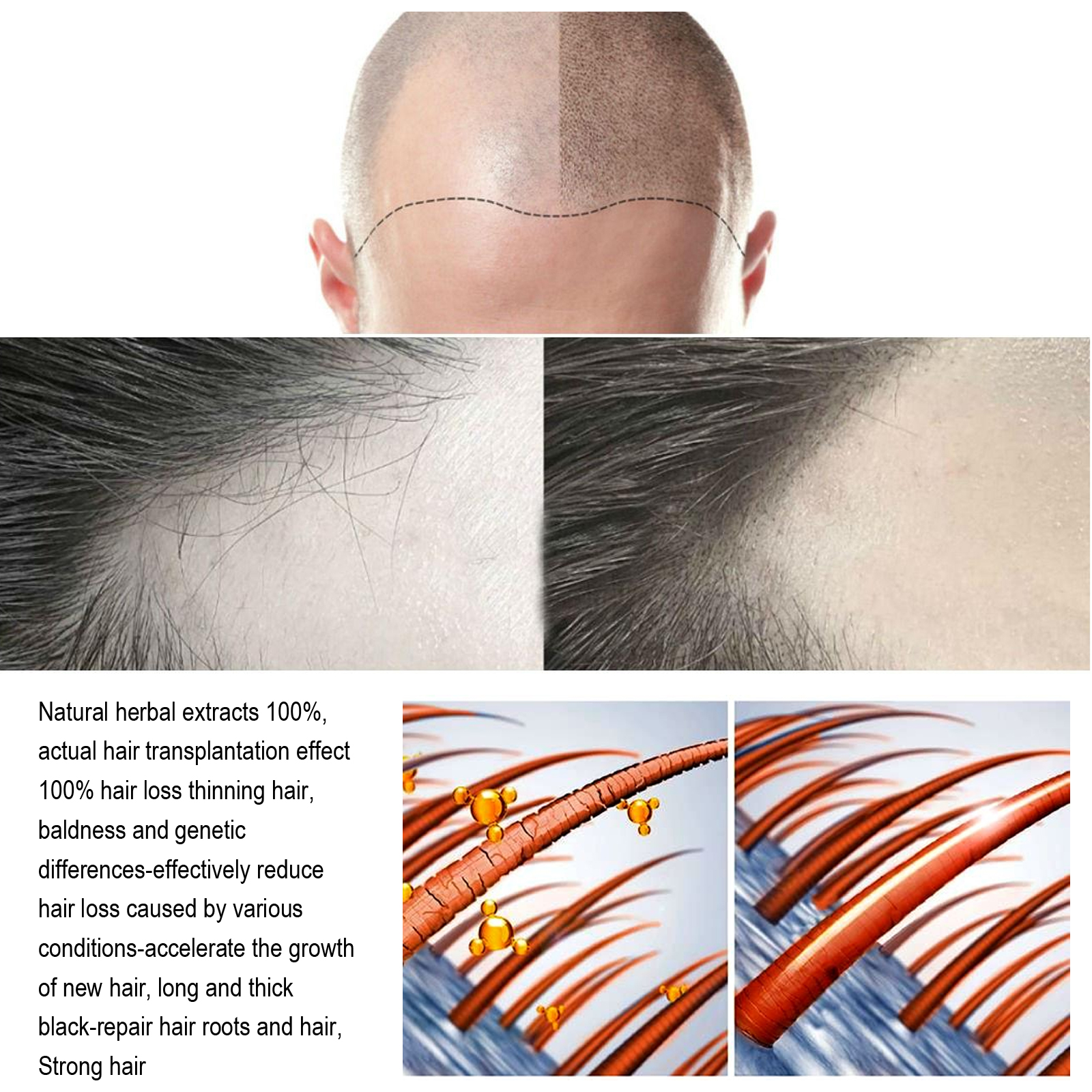 Jaysuing Hair Treatment, Strengthens Hair, Nourishes Root Growth And Thickens Scalp Massage Nutrient Solution