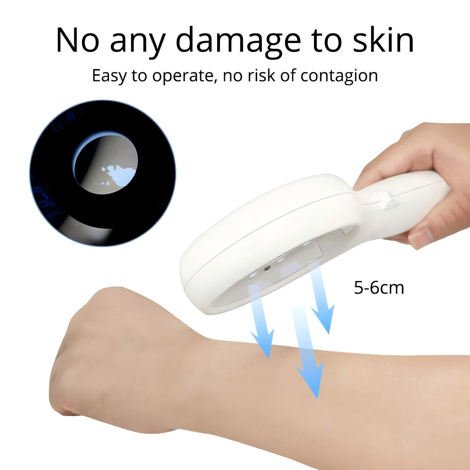 Woods Lamp Beauty Salon Spa Facial Care Analyzer UV Light Skin Diagnose Tester