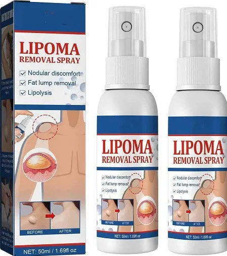 South Moon - Lipoma Removal Spray - 50Ml