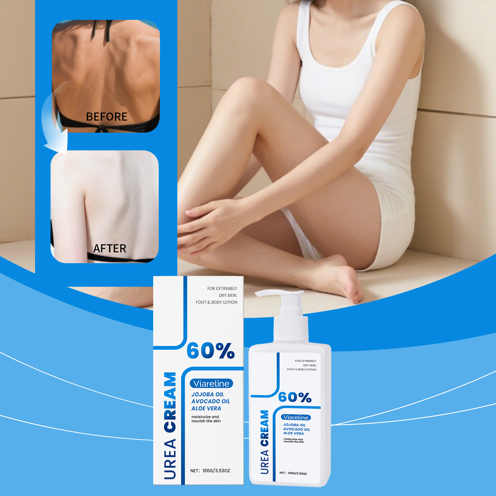 Urea Body Lotion — foto 5