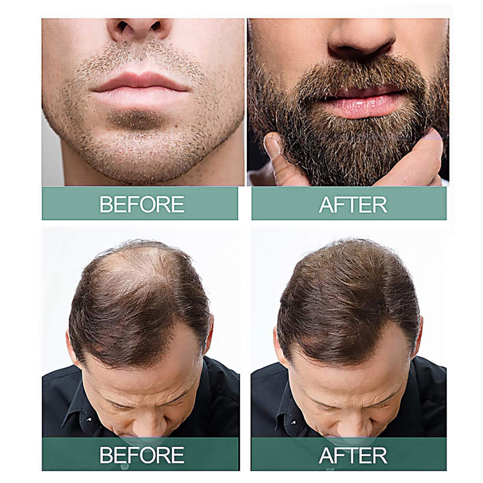New Hairline Anti-drop - Image 8
