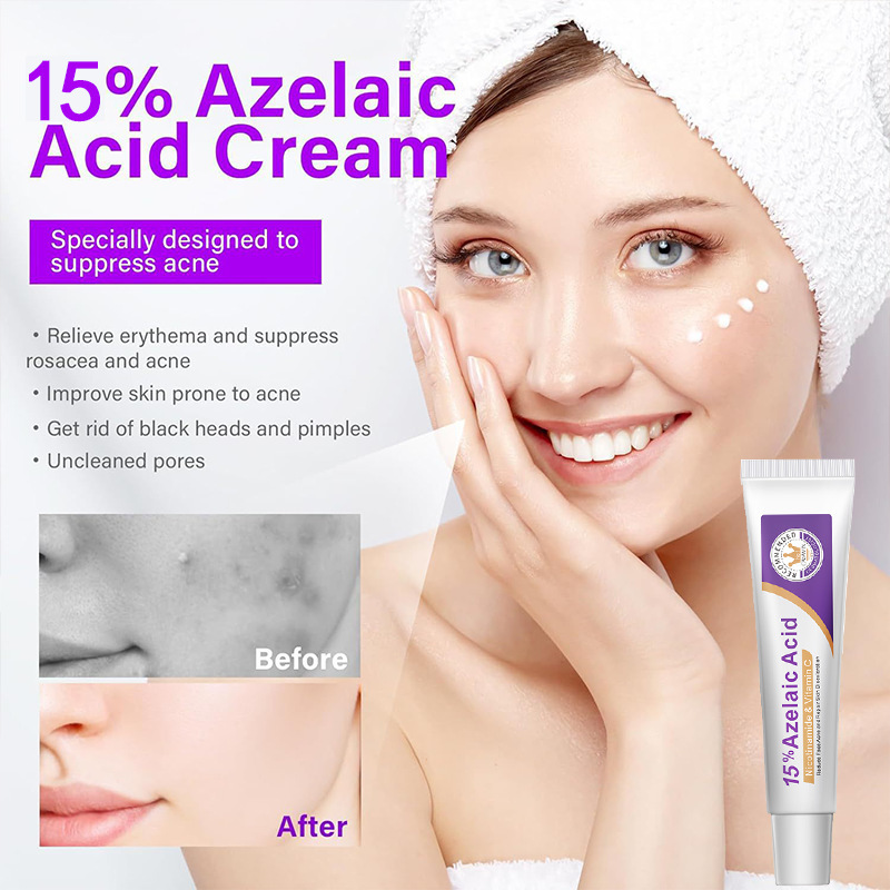 Azelaic Acid Serum