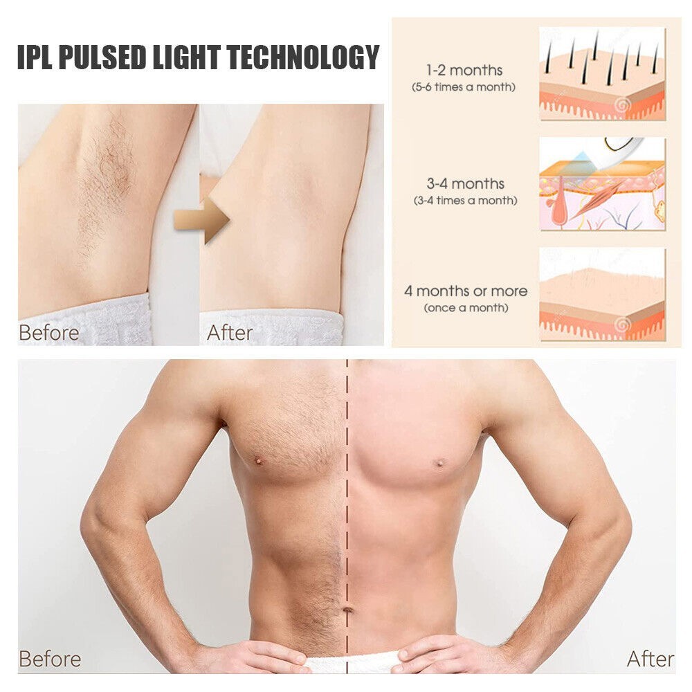 IPL Laser Permanent Hair Removal Device Painless Pulse Home Use — image 9
