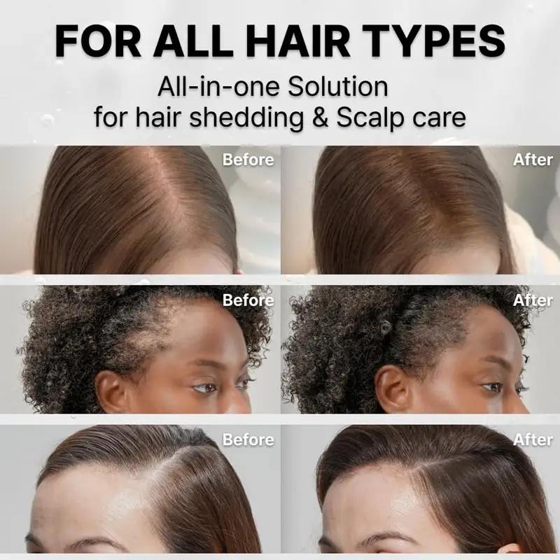 Hair Serum With Applicator Brush100ml