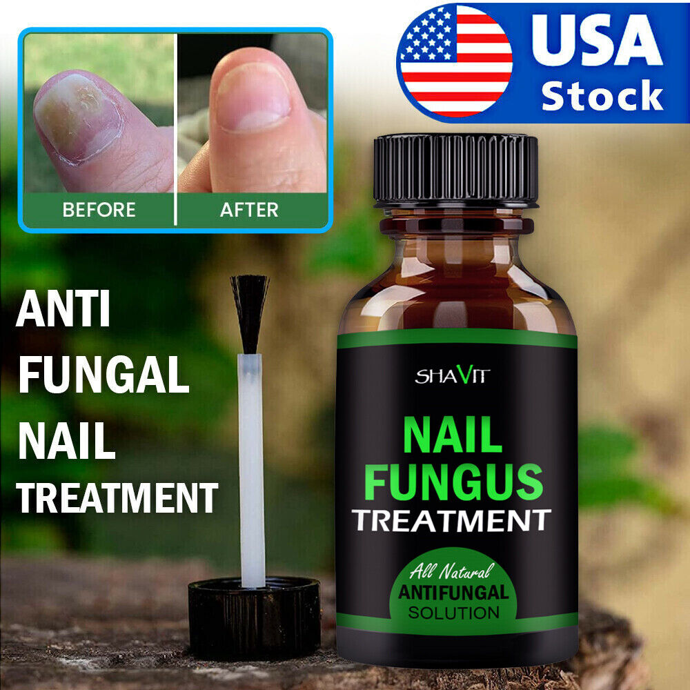 Nail AntiFungal Nail Solution - Maximum Strength 25% Solution for Nail  Fungus and Toenail Fungus,2 Pack - Walmart.com