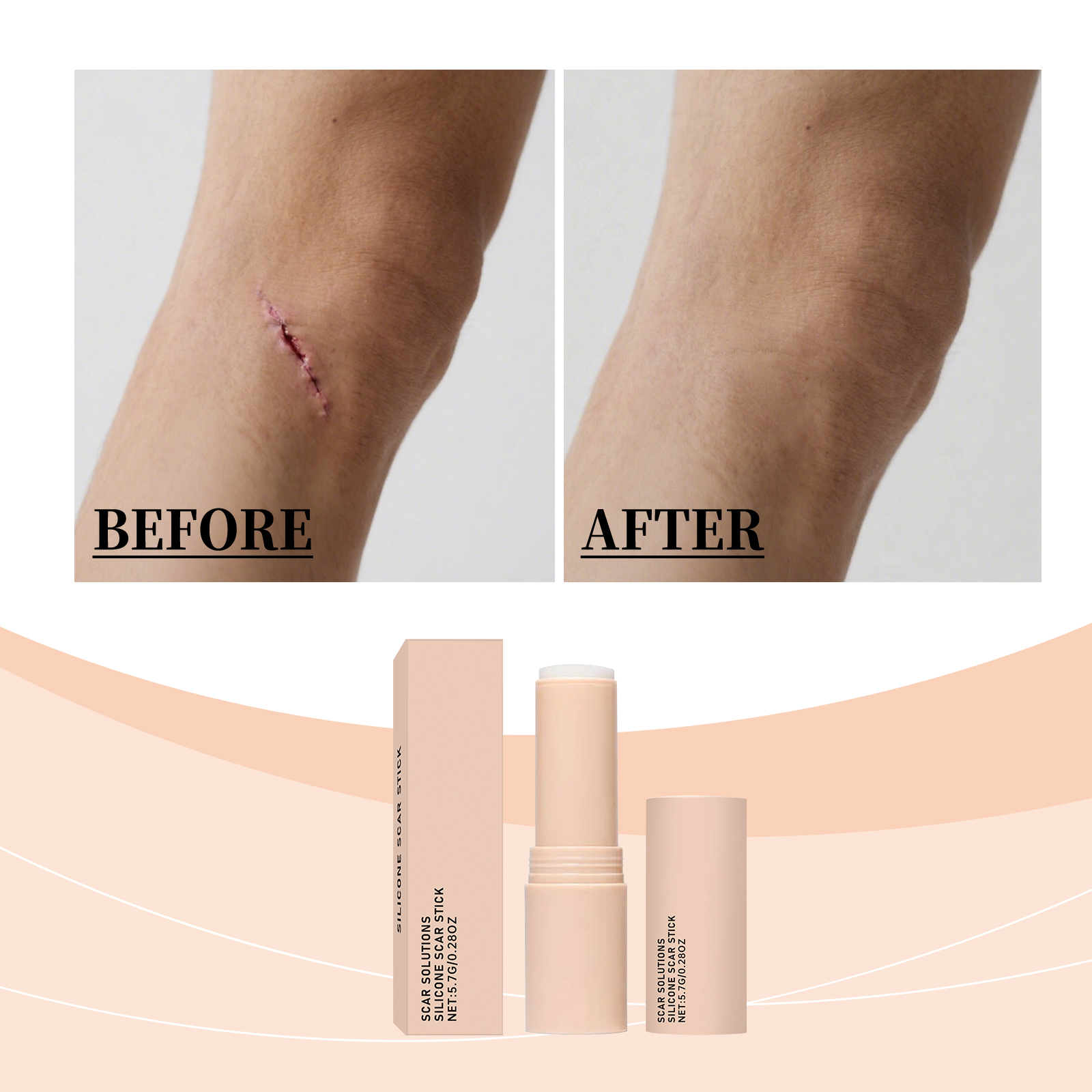 Scar Lightening And Moisturizing Stick — foto 6