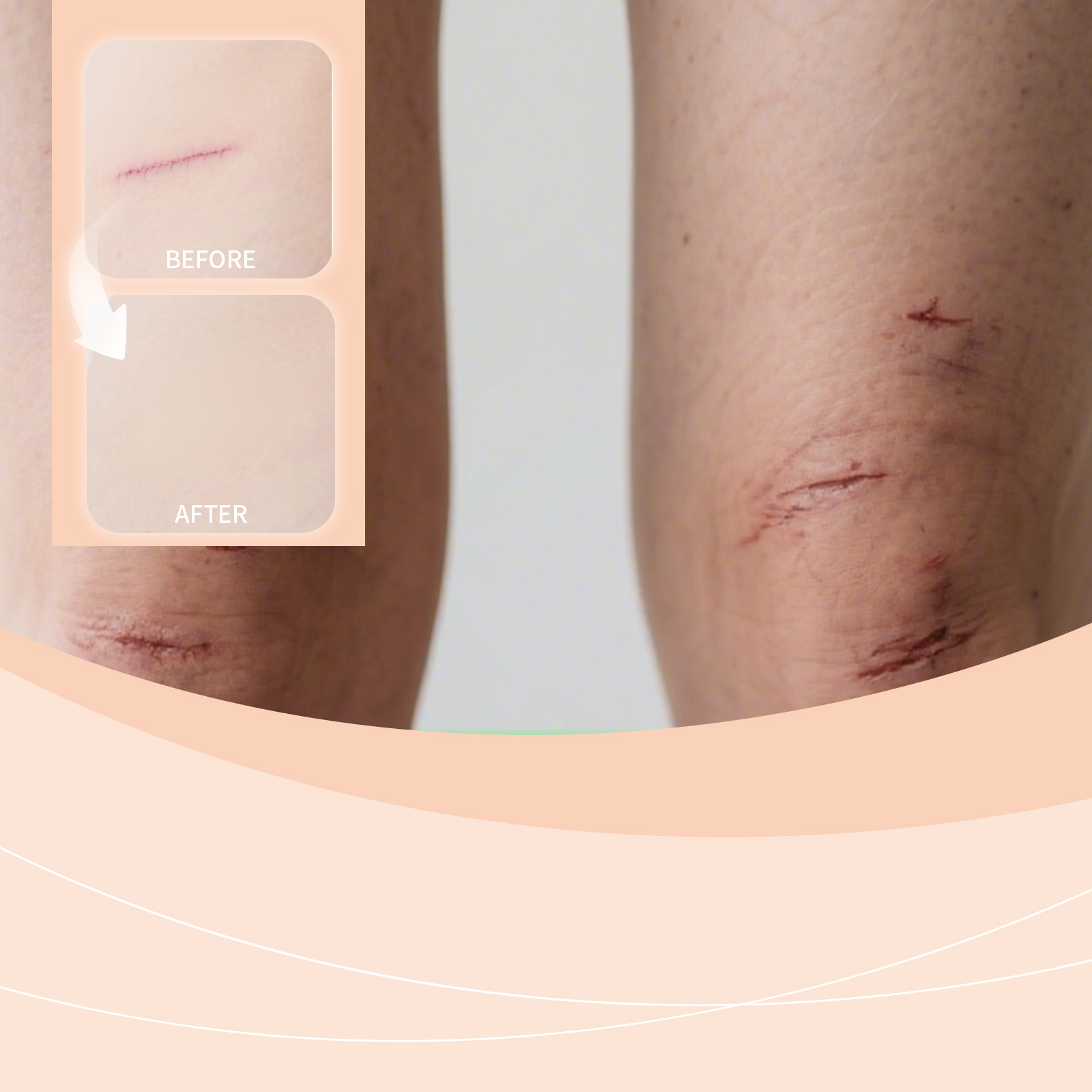 Scar Lightening And Moisturizing Stick — foto 4