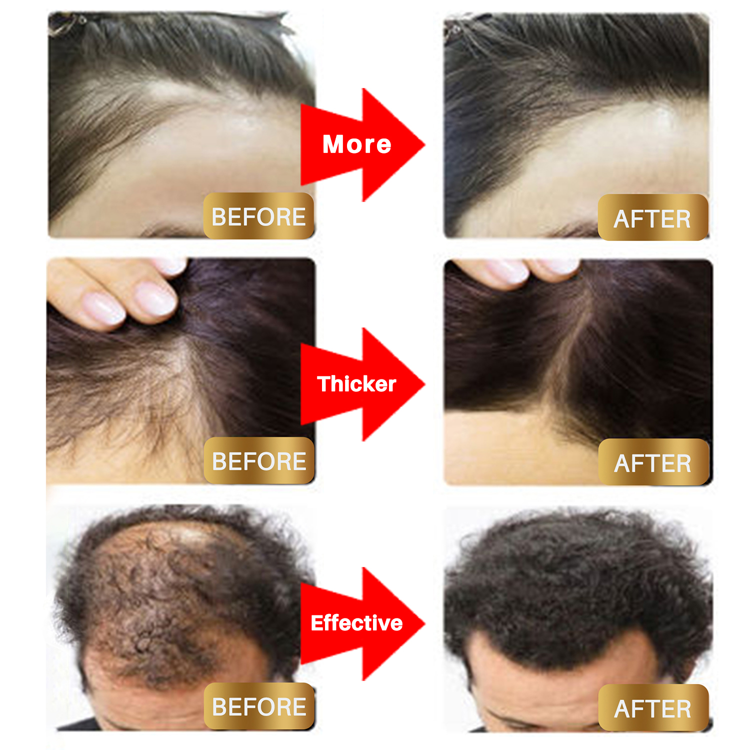 Biotin Hair Growth Spray